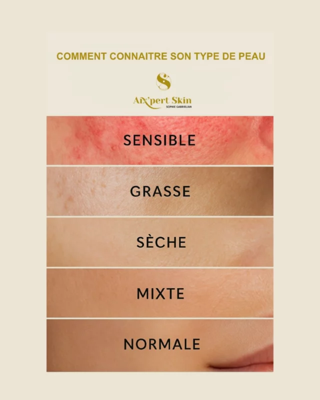 🌿 Connaître son type de peau, c’est le point de départ de toute routine efficace.
Votre peau vous parle. Chaque jour, elle manifeste ses besoins : brillance, tiraillements, rougeurs, inconfort…
Mais encore faut-il savoir les interpréter.

Chez Aixpert Skin, nous croyons qu’il n’existe pas de “bonne” ou “mauvaise” peau — il n’y a que des peaux mal comprises.
Identifier votre type de peau, c’est vous donner les moyens de faire les bons choix cosmétiques, pour des résultats visibles, durables et respectueux.

🔍 Voici comment mieux comprendre votre peau :

🔴Peau sensible : réactive, souvent rouge ou inconfortable ➔ optez pour des soins ultra-doux, apaisants et protecteurs.
🧈Peau grasse : aspect brillant, pores visibles, imperfections ➔ misez sur des textures légères, régulatrices et non comédogènes.
🌵Peau sèche : sensation de tiraillement, rugosité ➔ priorisez des soins riches, nourrissants et relipidants.
💿Peau mixte : brillante sur la zone T, sèche ailleurs ➔ adaptez votre routine zone par zone, avec des produits ciblés.
👍 Peau normale : confortable, équilibrée ➔ continuez à l’entretenir avec des soins hydratants et protecteurs.

✨ Chez Aixpert Skin, chaque peau est traitée comme un univers à part entière.
Notre expertise repose sur une approche personnalisée et l’utilisation de formules adaptées, sélectionnées en fonction de votre profil cutané réel.

🌱 Une peau en harmonie, c’est le reflet d’une routine cohérente, d’une écoute attentive et de soins choisis avec justesse.

💬 Et vous, avez-vous déjà identifié votre type de peau avec certitude ?
Quelle est votre plus grande difficulté dans votre routine actuelle ? On en parle en commentaire ! 😊

📍 Retrouvez tous nos conseils en cabinet ou en ligne avec Aixpert Skin. Votre peau mérite cette attention.

#AixpertSkin #TypeDePeau #DiagnosticPeau #RoutineBeauté #SoinsVisage #BeautéNaturelle #PeauÉquilibrée #SkincareIntelligent #PeauSaine